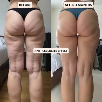 CELLUMOVE™ || 3D Metabolic Booster Leggings
