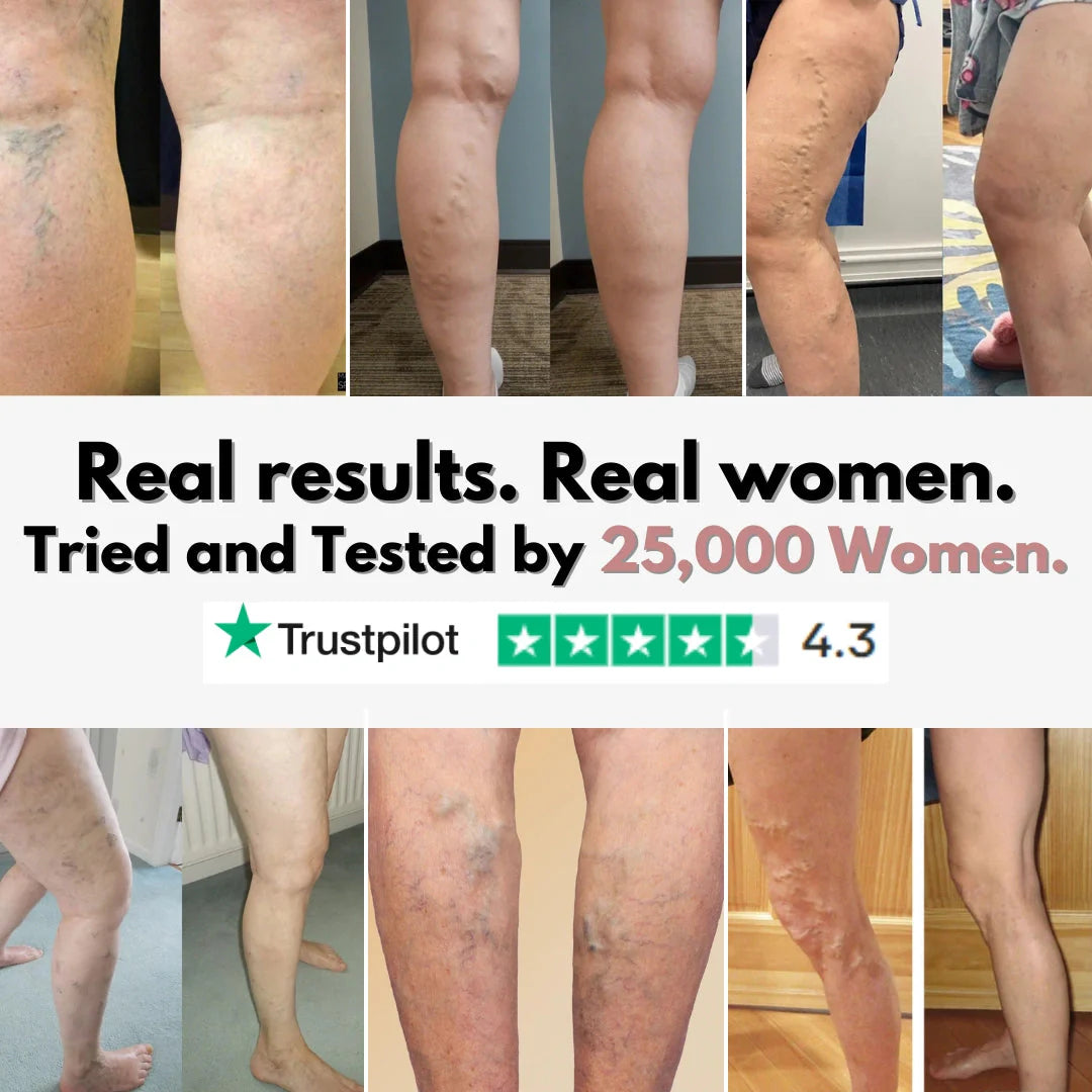 From Spider Vein & heavy legs to visible relief for healthcare workers in 14 days.