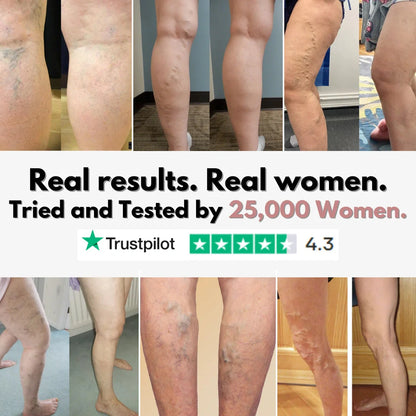 From Spider Vein & heavy legs to visible relief for healthcare workers in 14 days