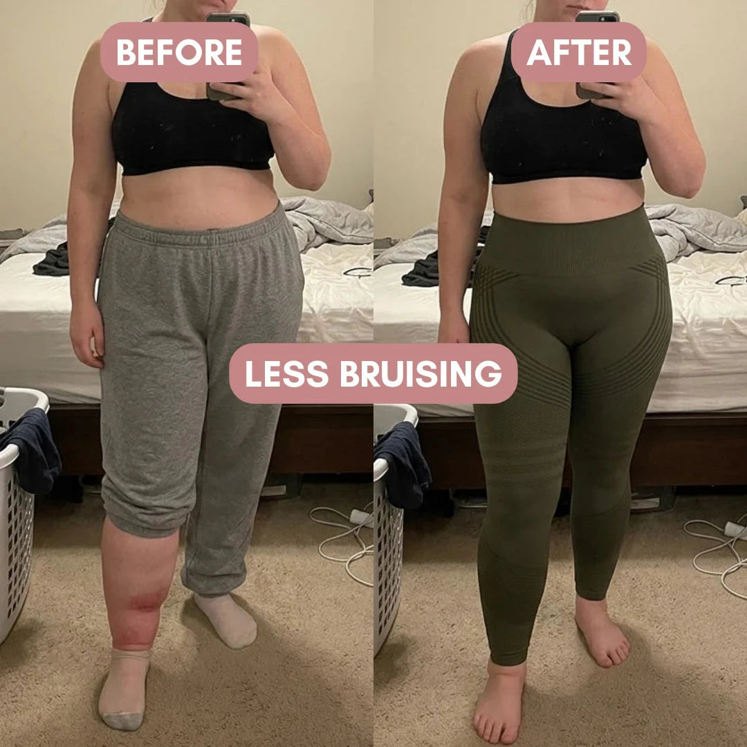 3D Legging – For Legs That Felt Like Anvils