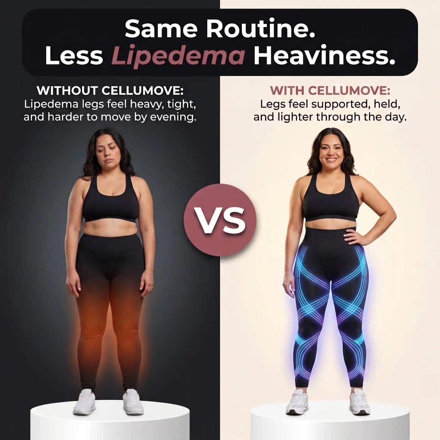 3D legging - say goodbye to lipedema pain and swelling naturally