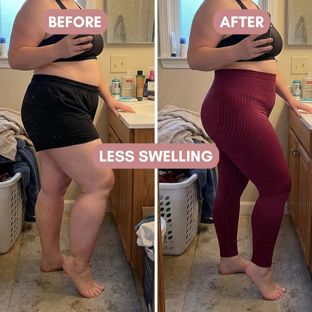 3D Legging – For Legs That Felt Like Anvils