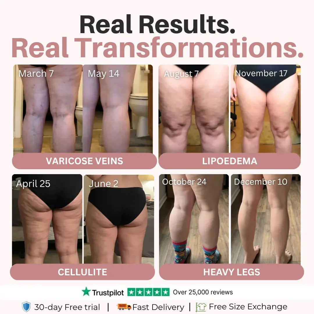 3D Legging — Daily lymphatic drainage