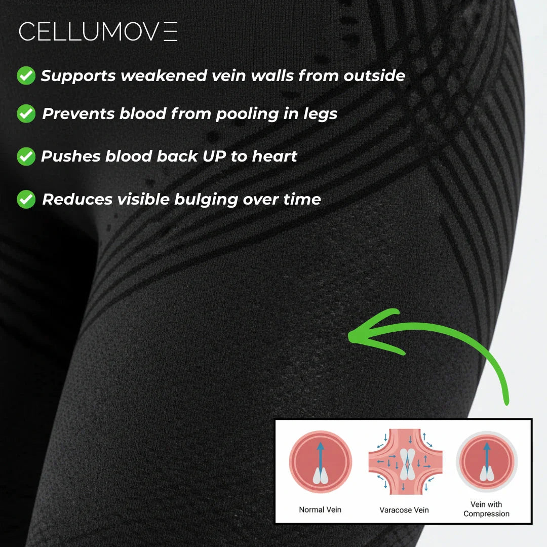 Visible Vein Relief in Just 14 Days with Cellumove 3D Compression Leggings