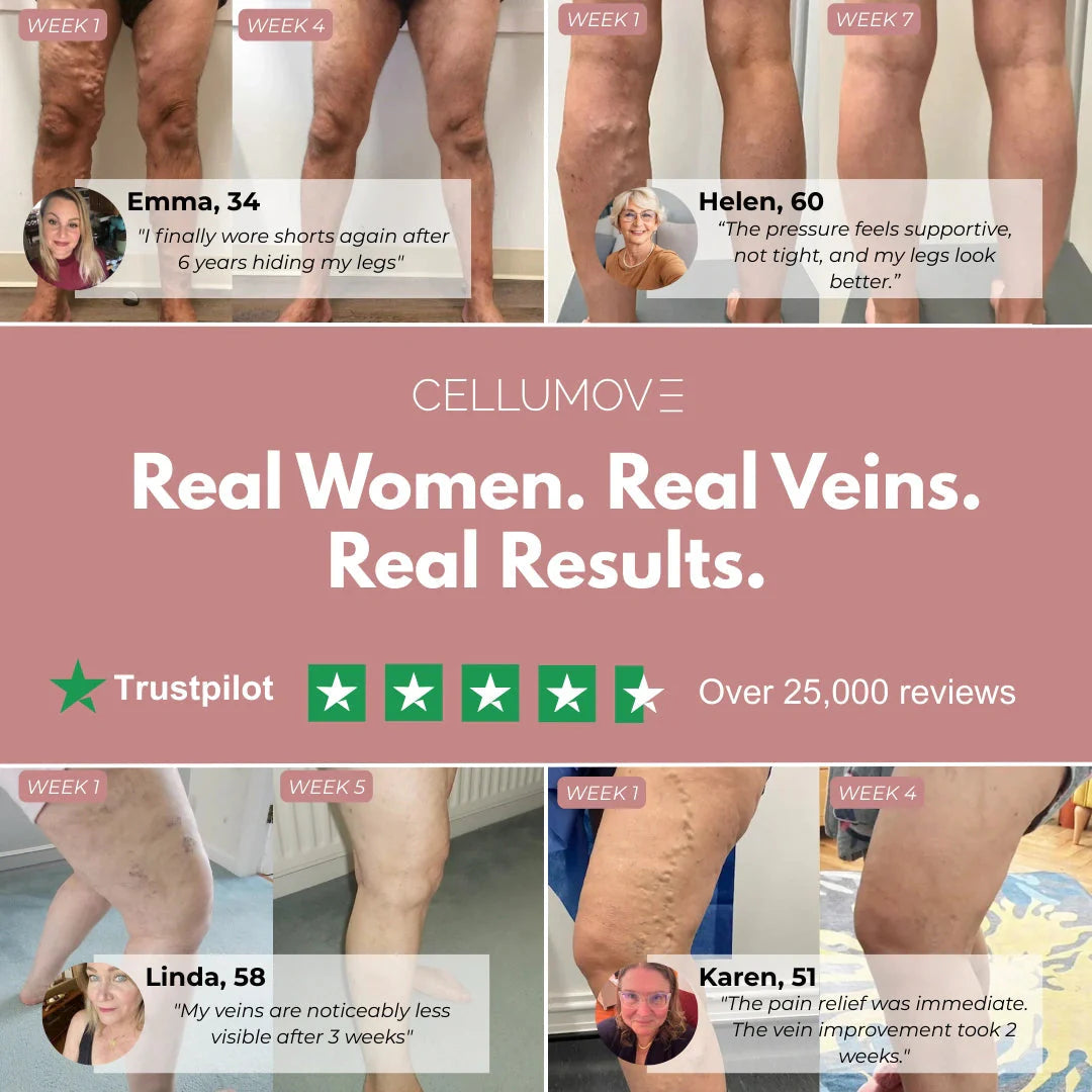 Visible Vein Relief in Just 14 Days with Cellumove 3D Compression Leggings