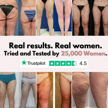 Firmer, smoother legs in 14 days — for women tired of saggy skin holding them back