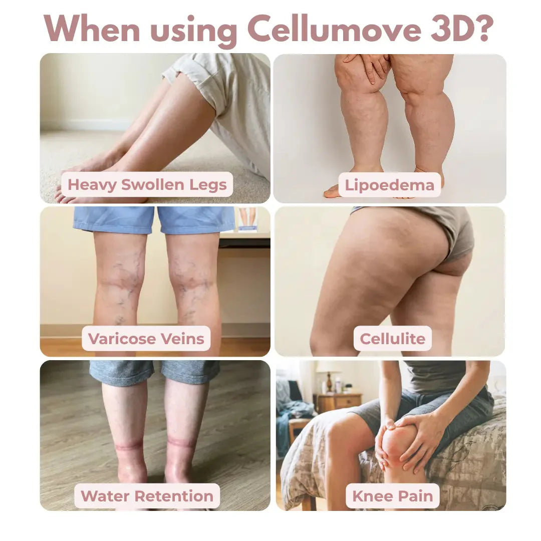 3D Legging — Daily lymphatic drainage