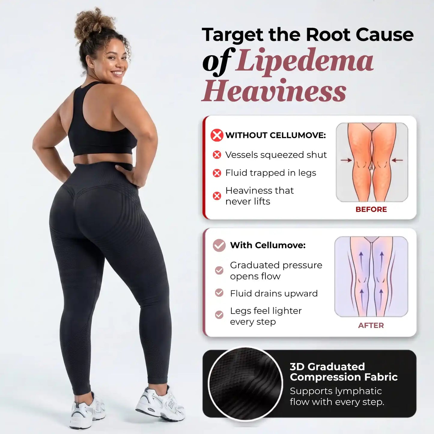 3D legging - say goodbye to lipedema pain and swelling naturally