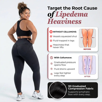 3D legging - say goodbye to lipedema pain and swelling naturally