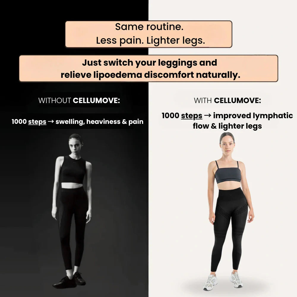 3D Legging – Say goodbye to lipoedema pain and swelling naturally